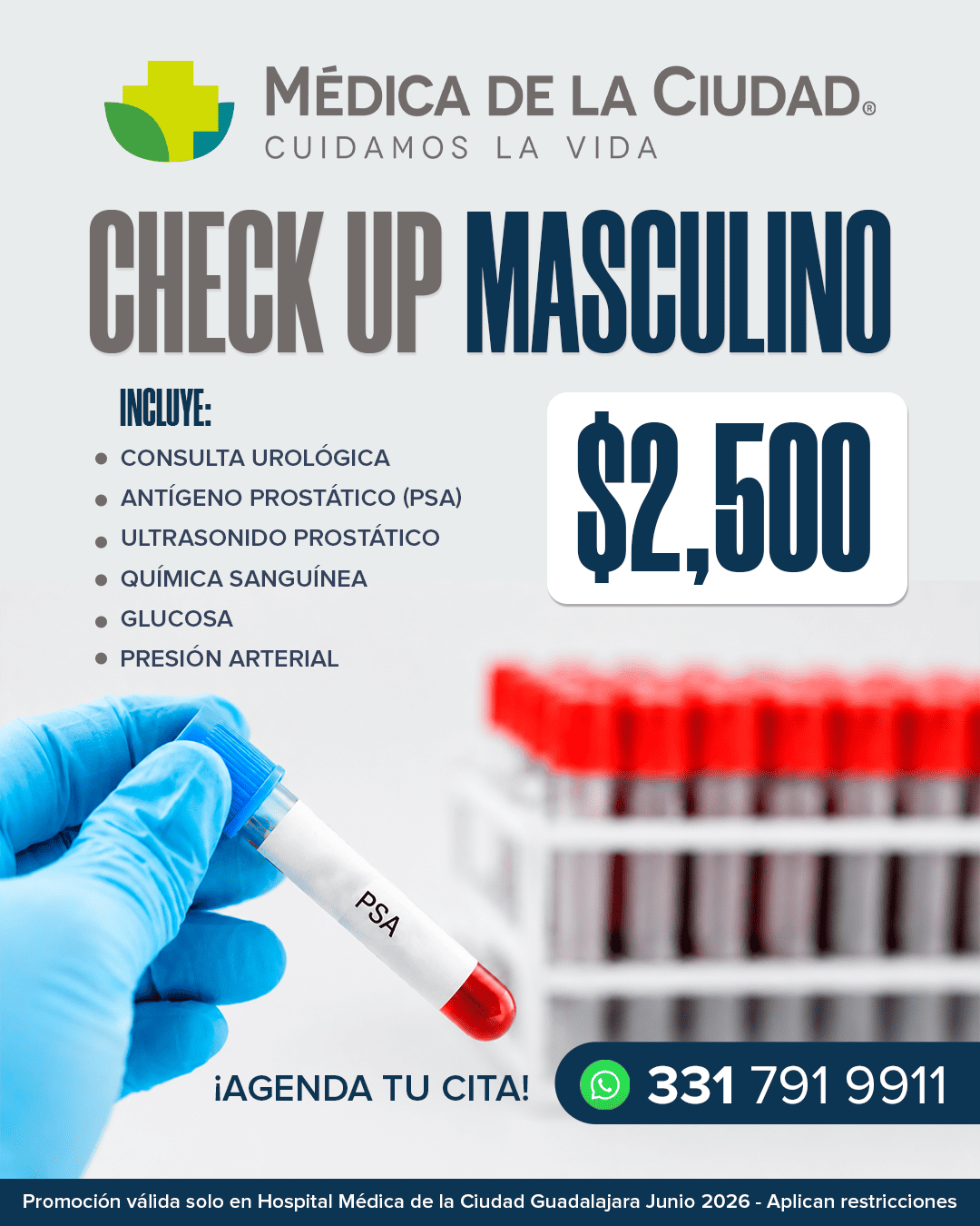 checkup antigeno gdl